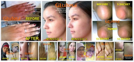 glutera_glutathione_indonesia2
